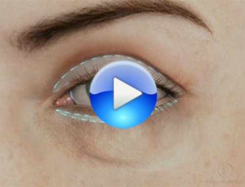 Disimular bolsas y ojeras