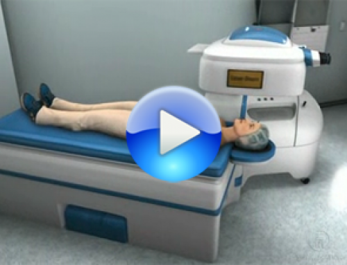 Clínicas con laser femtosegundo en Málaga, Marbella y Fuengirola