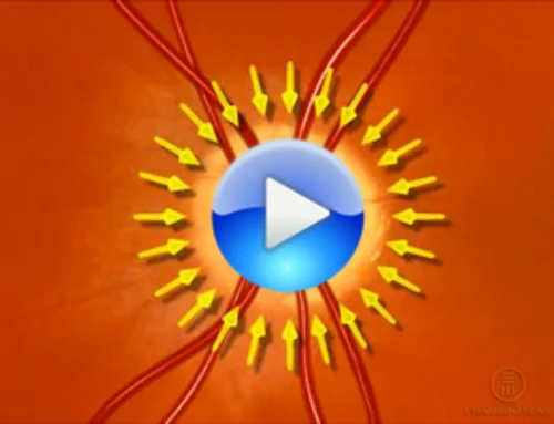 Glaucoma, risk factors and treatment