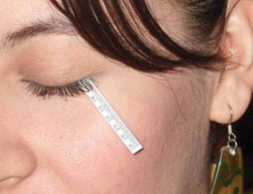 LASIK con ojos secos