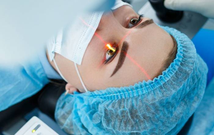 cirugia refractiva laser