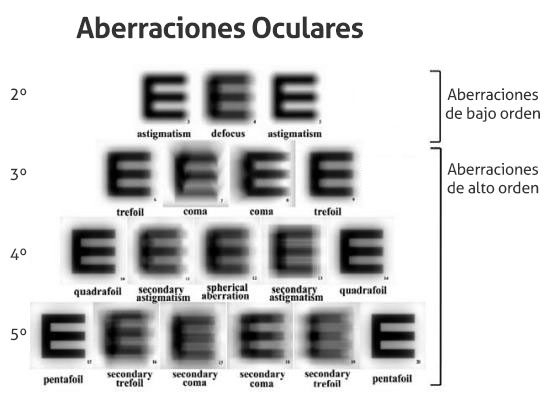 Aberraciones Oculares