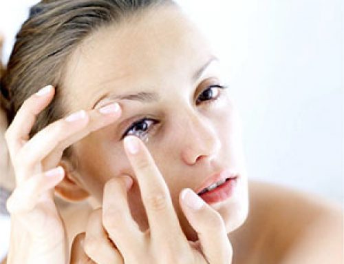 LASIK o lentes de contacto