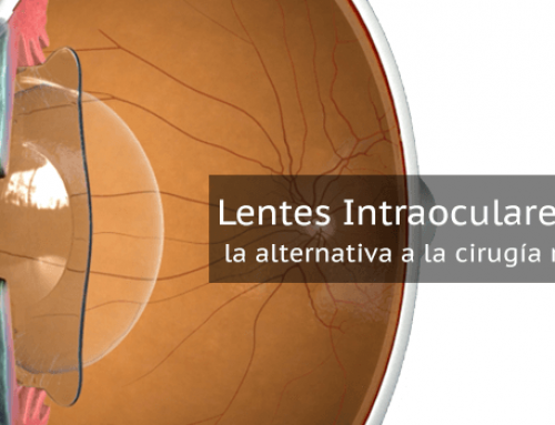 Lentes intraoculares fáquicas