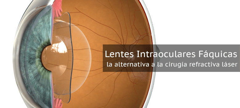 Lentes intraoculares fáquicas