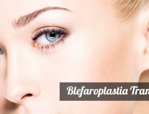 Lower transconjunctival blepharoplasty