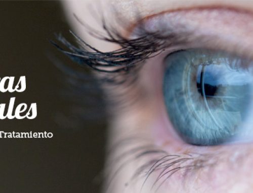 Úlcera corneal, causas, síntomas y tratamiento