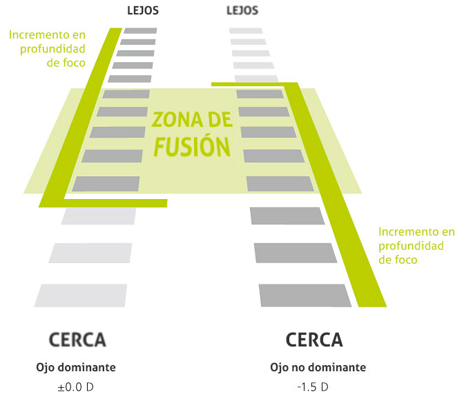 operación presbicia con laser blended vision