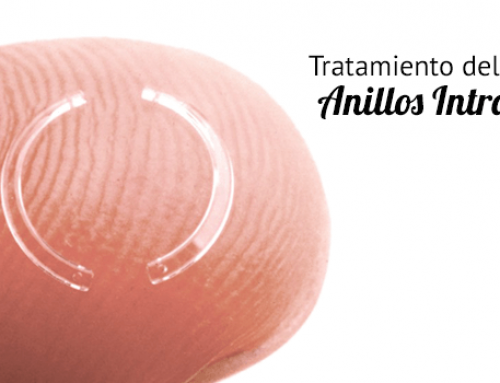 Tratamiento del Queratocono con anillos intracorneales