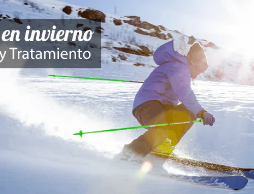 Prevenir la sequedad ocular en invierno