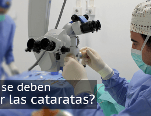 Cuándo se deben operar las cataratas