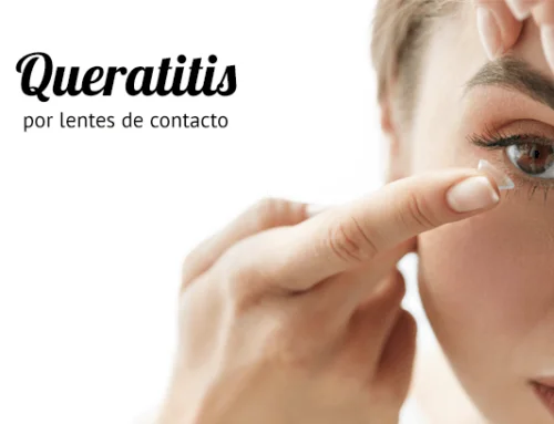 Queratitis por lentes de contacto