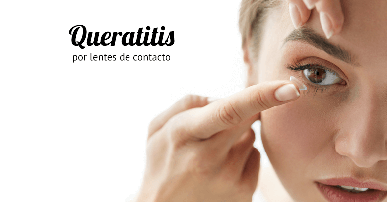 queratitis por lentes de contacto