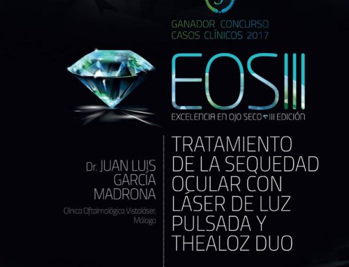 Tratamiento de la Sequedad Ocular con Láser de Luz Pulsada y Thealoz Duo