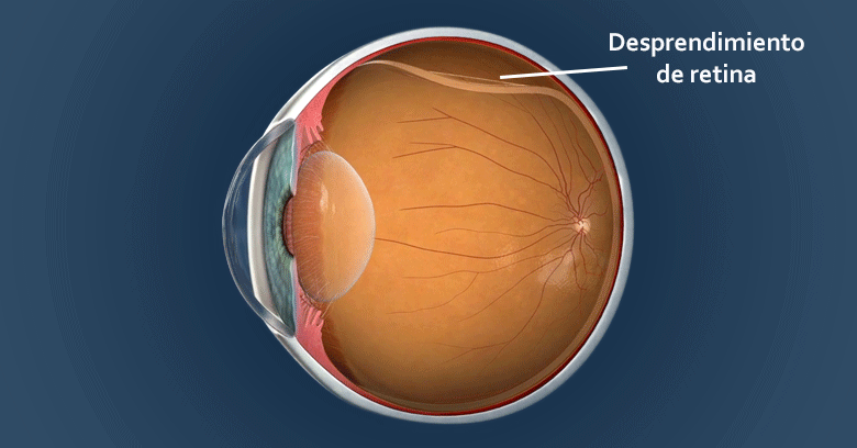 Crystal retinal