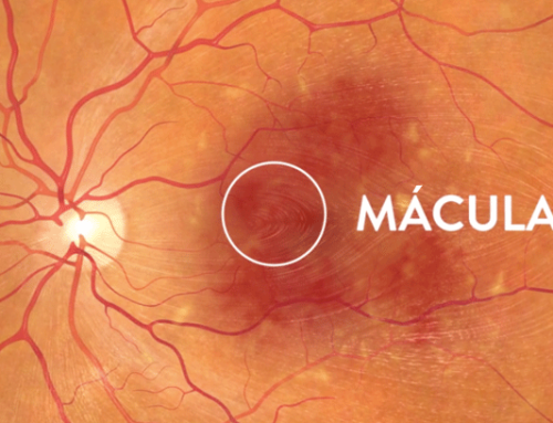 Alimentos para evitar degeneración macular