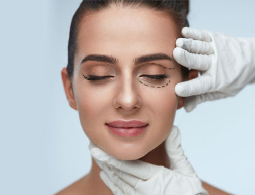 Recommended age for Blepharoplasty