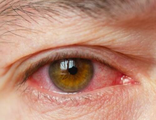 Derrame ocular, causas y tratamiento