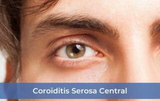 Coroiditis Serosa Central