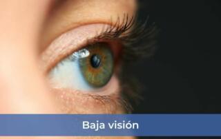 Baja vision
