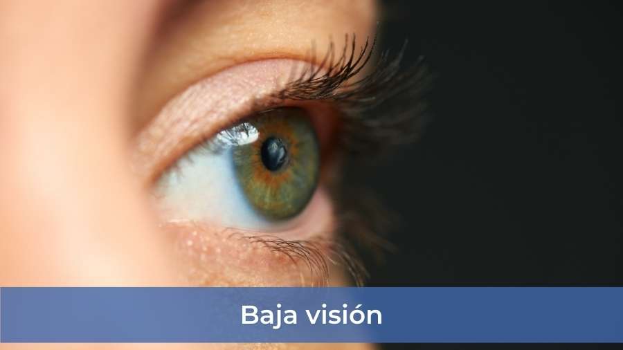 Baja vision