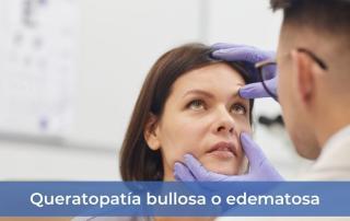 Queratopatía bullosa o edematosa