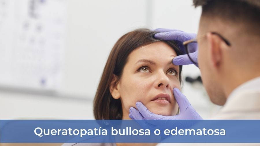 Queratopatía bullosa o edematosa