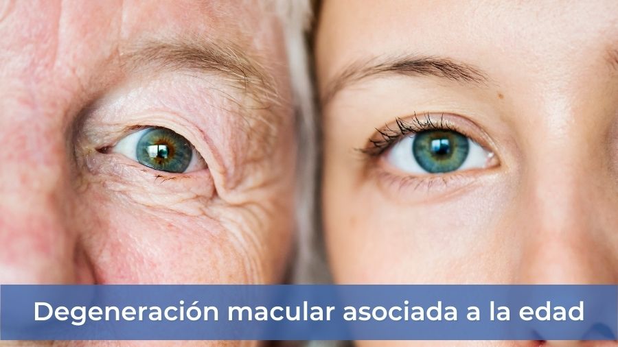 Degeneración macular asociada a la edad